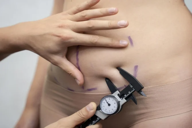 Doğum Sonrası Vücut Toparlama Estetiği Mommy Makeover Nedir ?